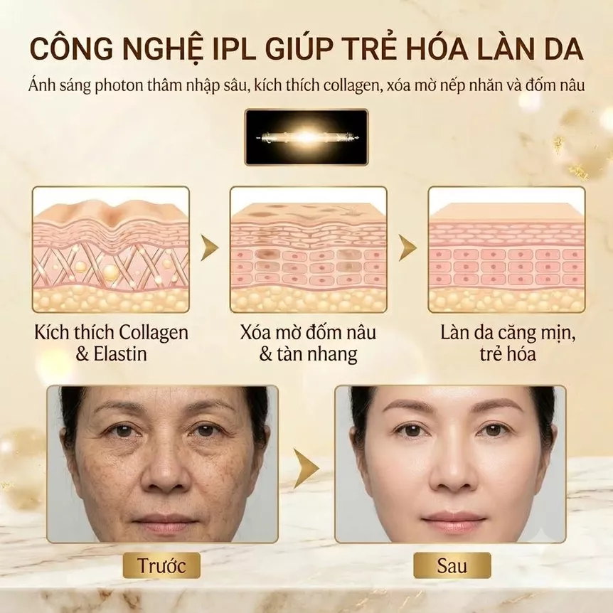 Máy triệt lông 4 trong 1 BAMIKO
